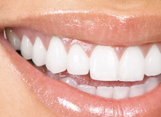 Wybielanie zębów u dentysty