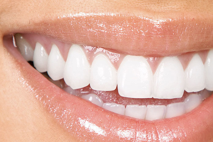 Wybielanie zębów u dentysty Wybielanie zębów u dentysty